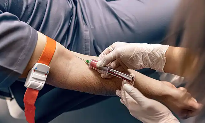 خدمات آزمایشگاهی در منزل تهران